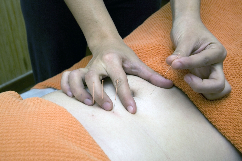 osteopathe-GRIMAUD-min_acupuncture-4175625